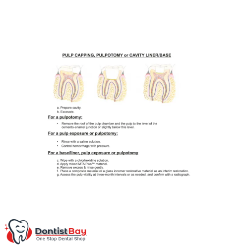 MTA Plus, Endodontic Cement by Prevest DenPro MTA Plus, Endodontic Cement by Prevest DenPro